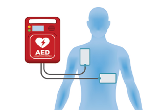 APS Optimización de localización de desfibriladores de uso público